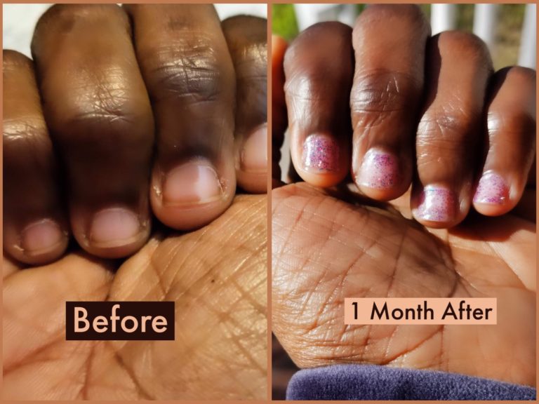 Quit Nail Biting | Nail Growth & Manicure Products